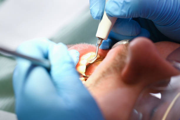 Best Cosmetic Emergency Dentistry in Seneca, IL