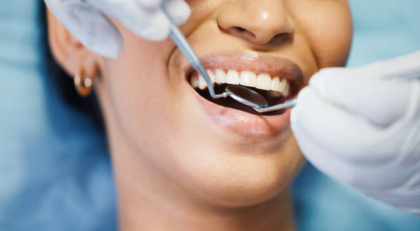 Best Emergency Gum Treatment in Seneca, IL