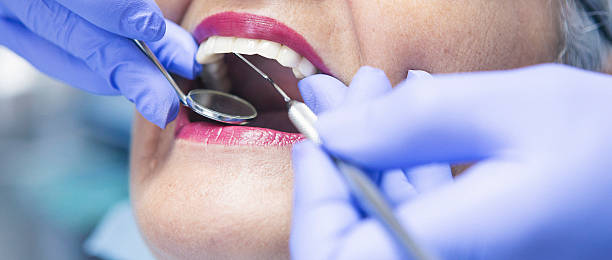 Best Emergency Dental Care for Broken or Chipped Teeth in Seneca, IL